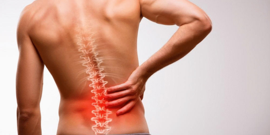 Hérnia de Disco: Entenda os Sintomas e Tratamentos sem Cirurgia